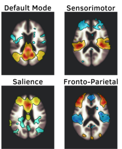 4 MRI images of brain networks